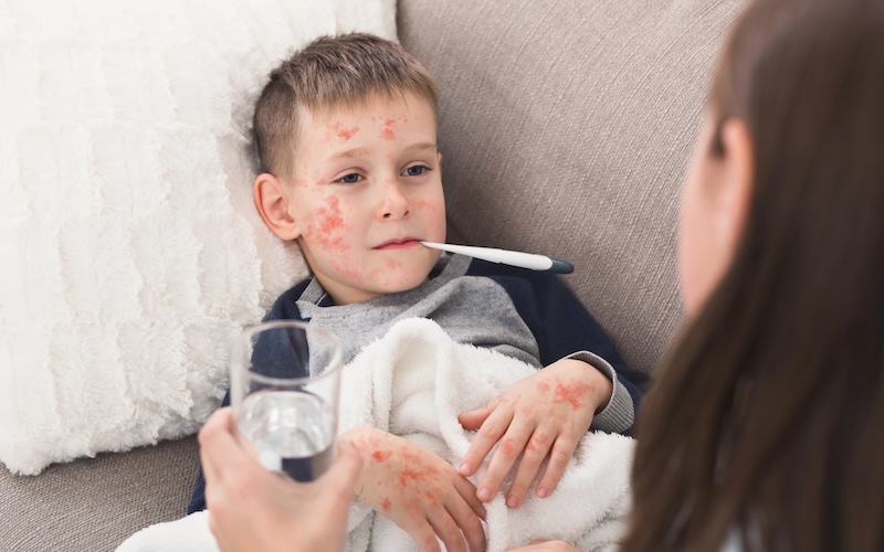 Mother caring for boy with measles at home, checking temperature